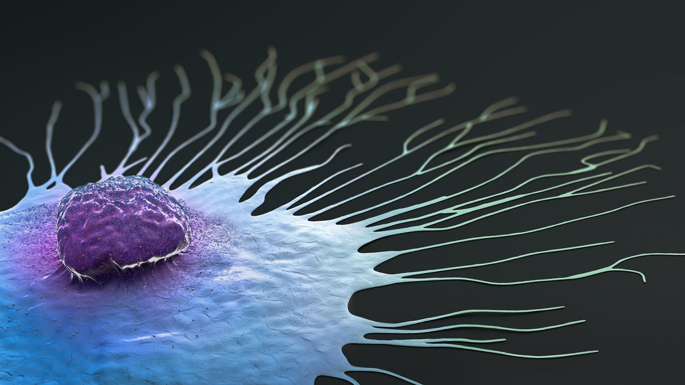 On en sait plus sur la propagation des cellules cancéreuses du sein dans tout le corps