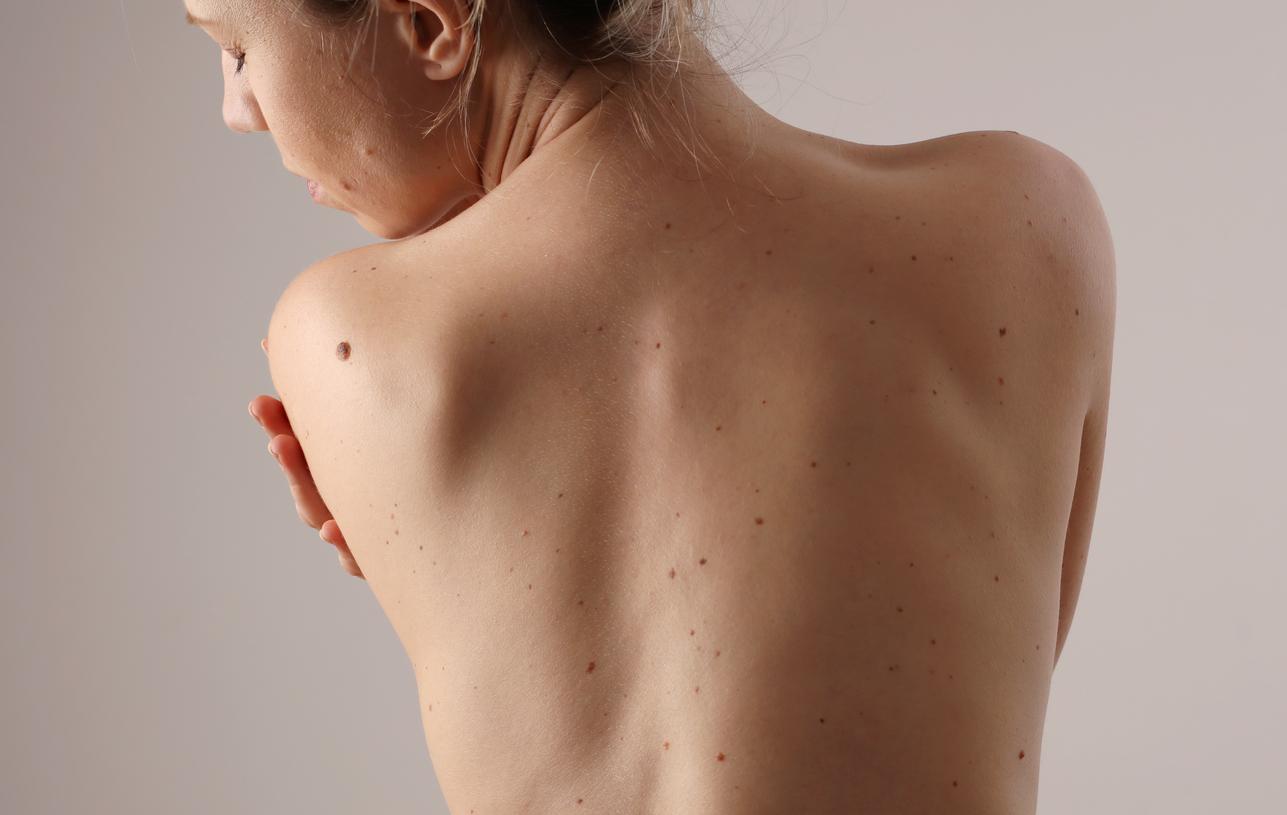 5 conseils d'une dermatologue pour préserver le microbiote de notre peau 
