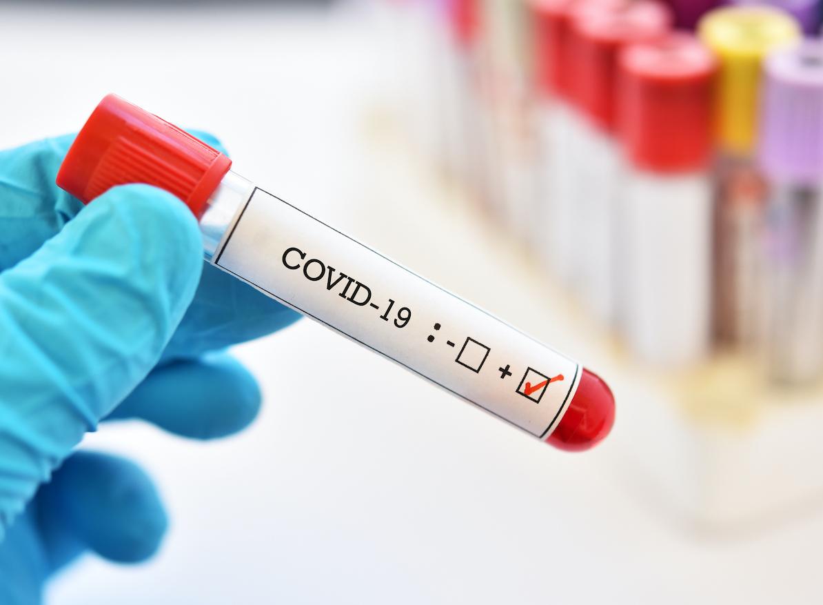 Covid-19 : une femme asymptomatique restée contagieuse pendant 70 jours