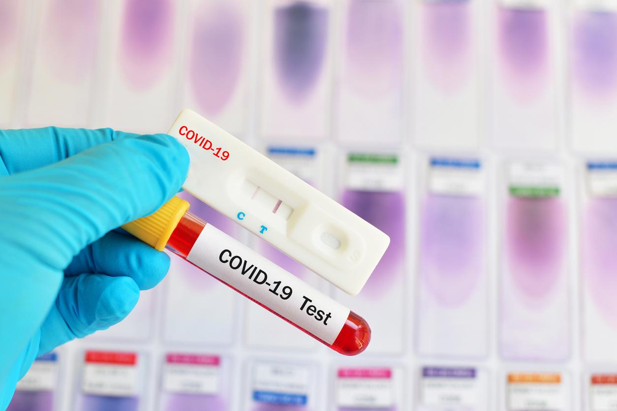 Test Trod et test PCR : quelles différences ? 