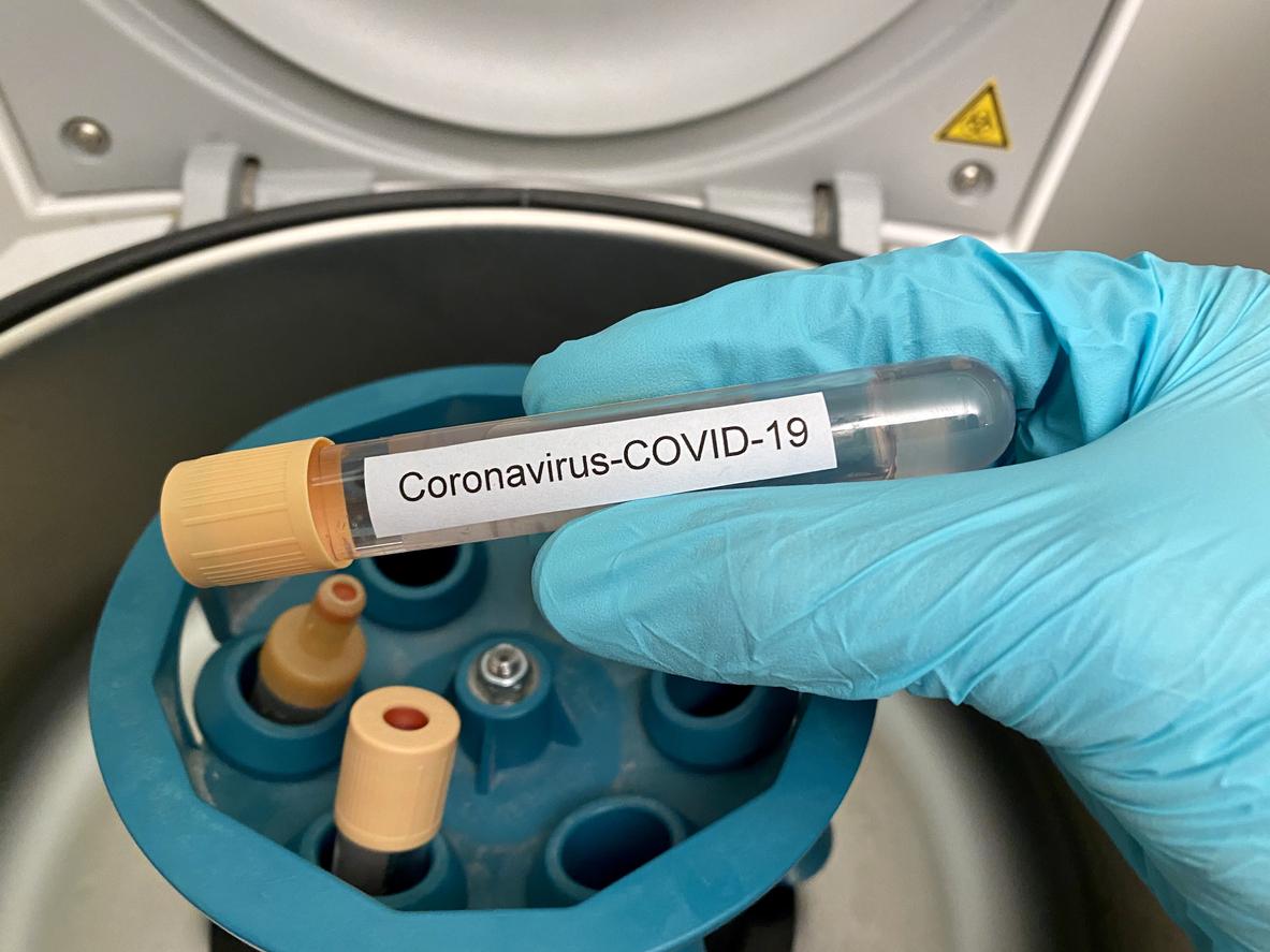 Covid-19 : un test salivaire à faire chez soi en 24 heures