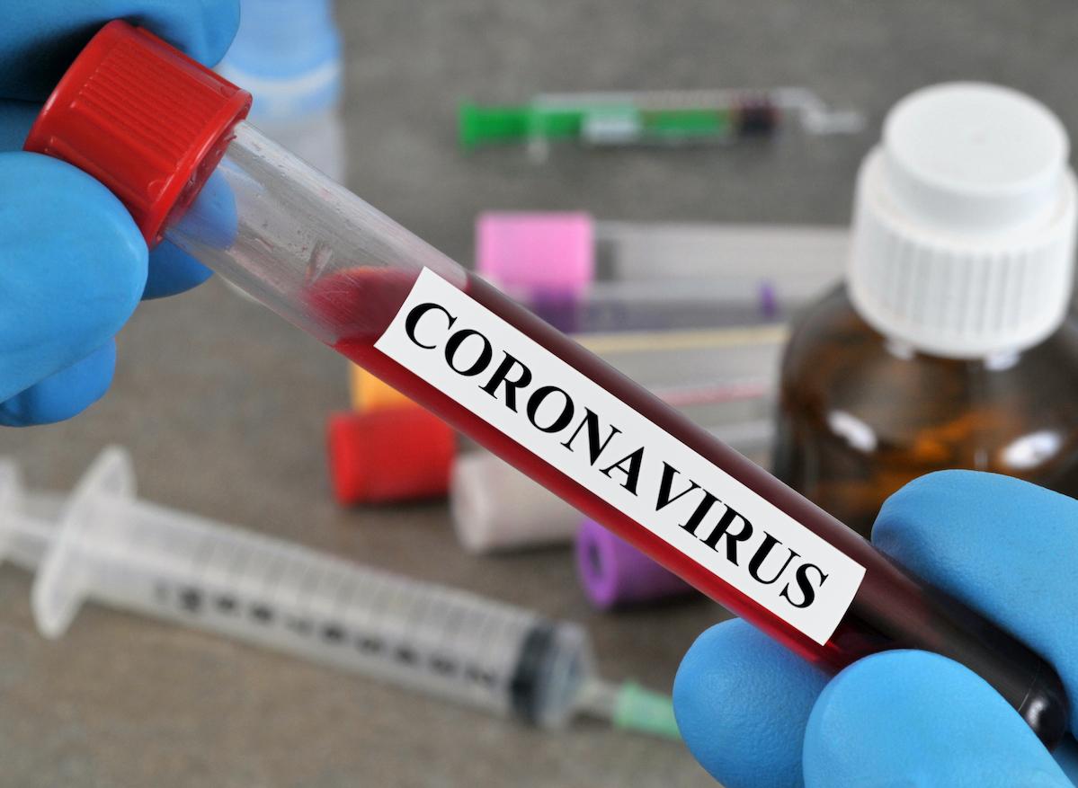 Covid-19 : un nouveau test sérologique plus efficace et précis bientôt disponible