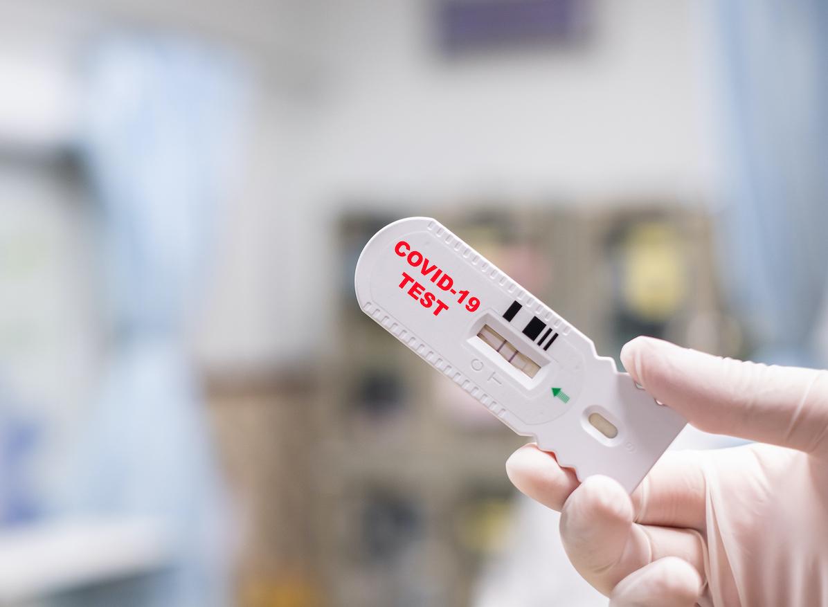En France, les tests PCR sont désormais remboursés à 100%