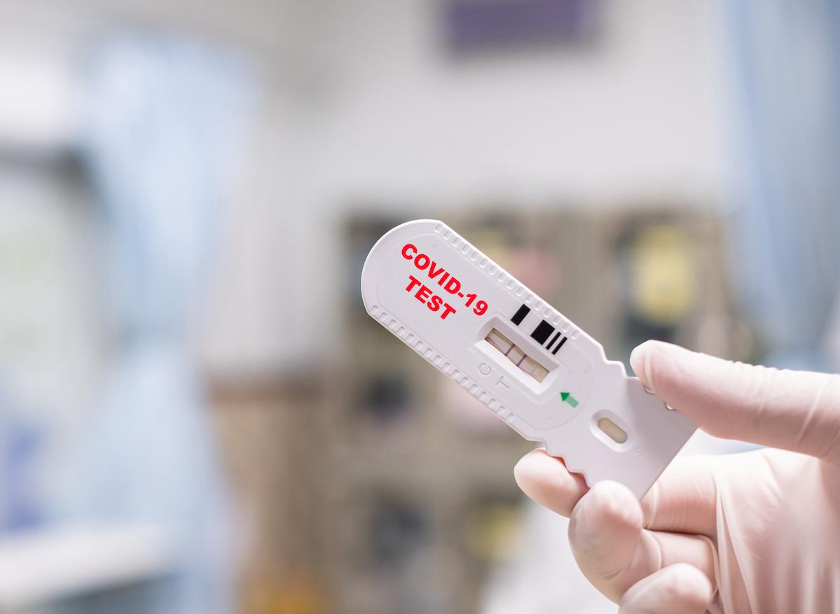 Covid-19 : du retard pour les autotests et un nouveau test sérologique simple et efficace
