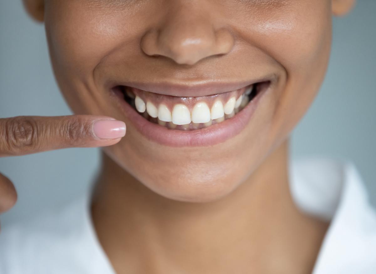Une pastille pourrait permettre de  reconstruire l’émail des dents 
