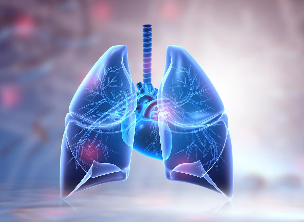 Cancer du poumon : chez les non-fumeurs, des signatures génétiques différentes