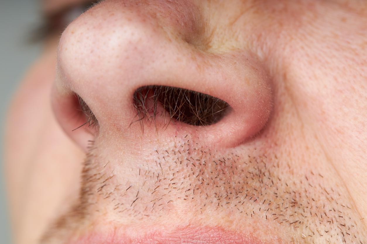 Il a du mal à respirer : les médecins trouvent une dent qui pousse... dans son nez !