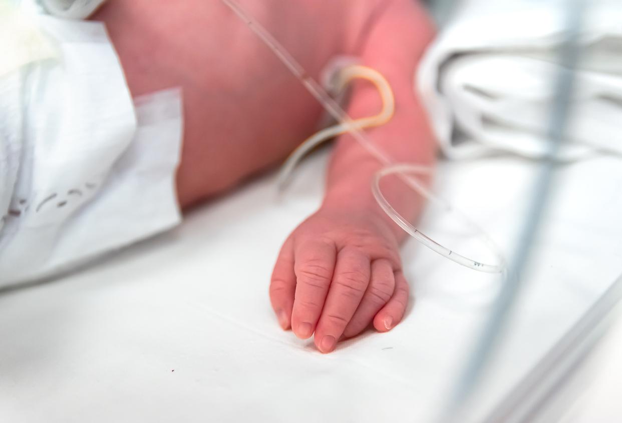 Anomalie congénitale : un bébé est né avec quatre reins 