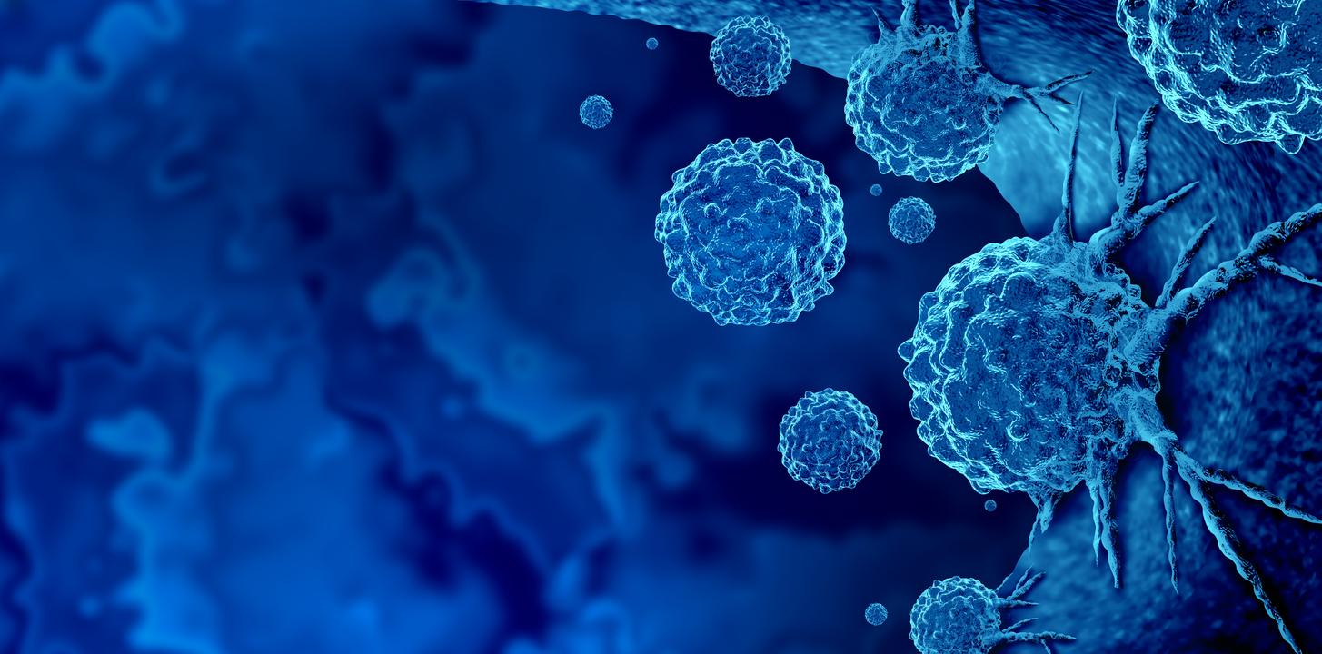 Cancer du sein : on sait comment il contourne les défenses immunitaires… et c’est une bonne nouvelle