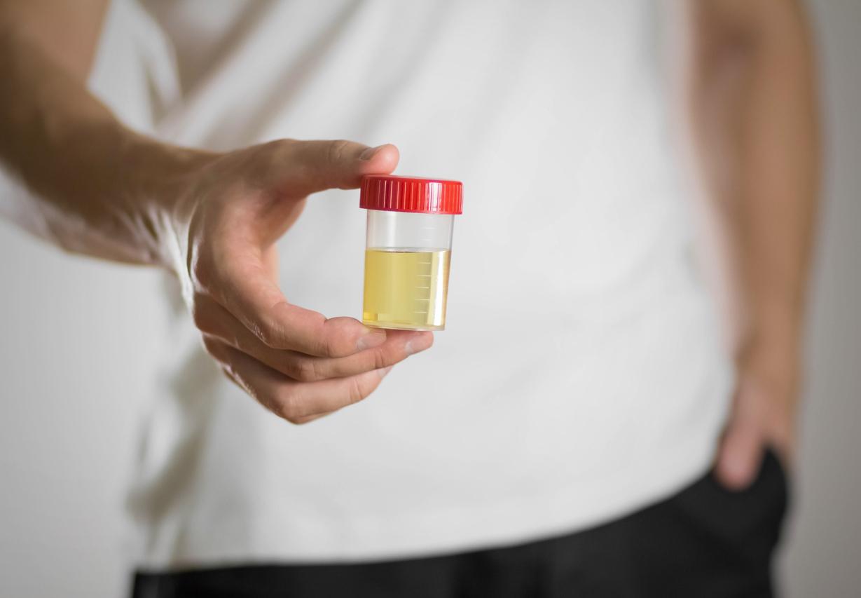 Urine : des chercheurs élucident le mystère de sa couleur jaune