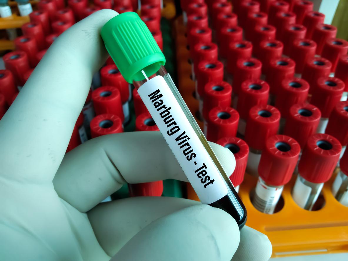 Le virus de Marburg identifié comme responsable de la mystérieuse maladie en Tanzanie