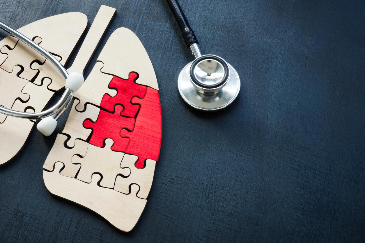 Cancer du poumon à petites cellules : on sait pourquoi tant de patients récidivent