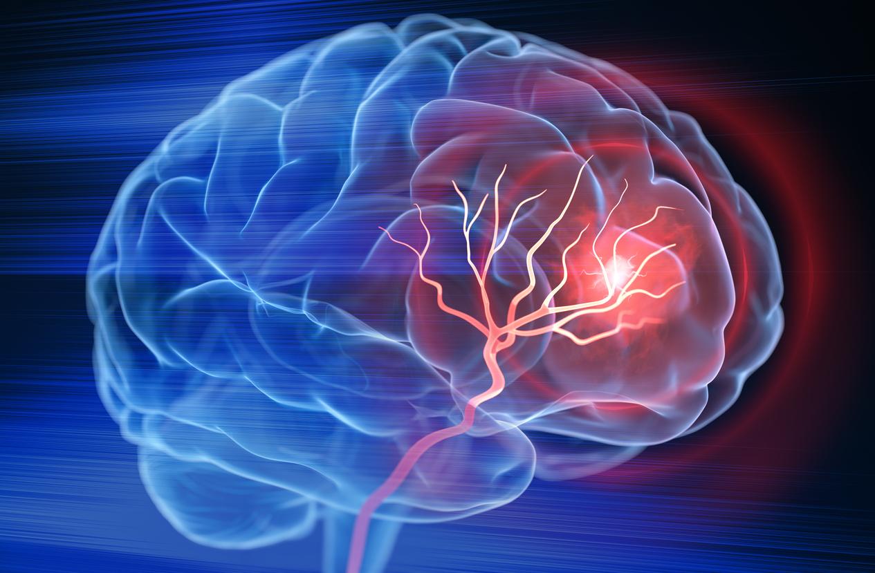 Fibromyalgia: areas of the brain that deal with pain may not work properly