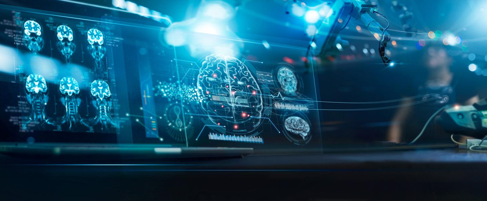 Une IA aide à décrypter l’un des mystères de la maladie d’Alzheimer 