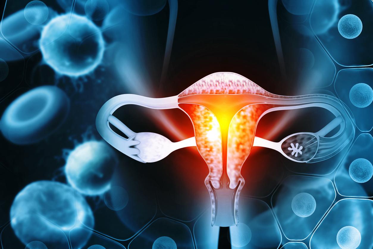 Retirer les lésions du col de l'utérus réduit les risques de cancer