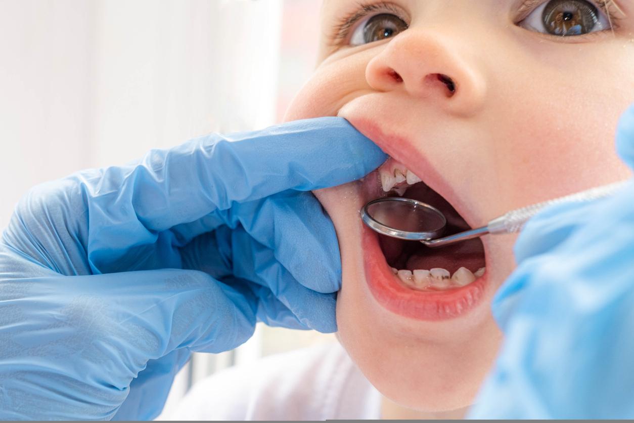 Grossesse : cette vitamine chez la maman réduit le risque de caries chez l’enfant