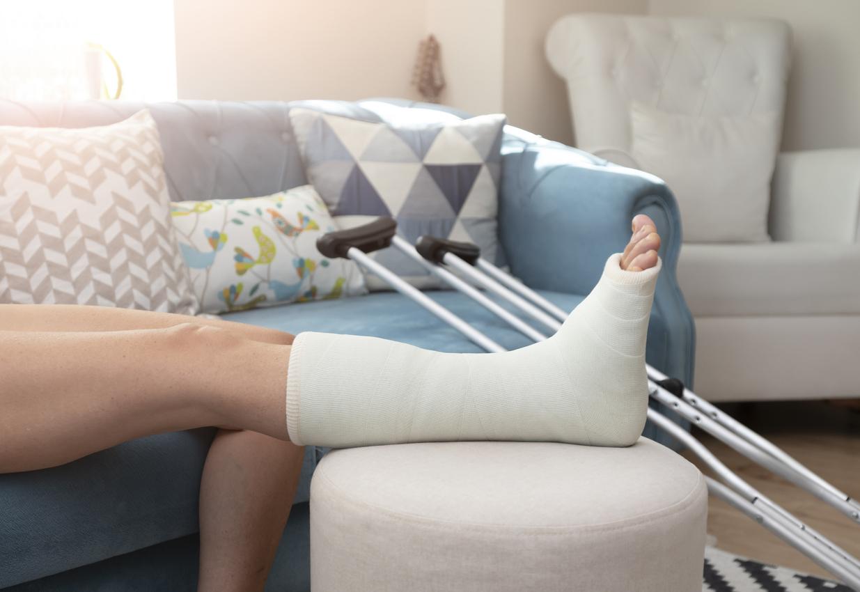 Fracture de la cheville : chirurgie ou plâtre, lequel est le plus efficace ? 