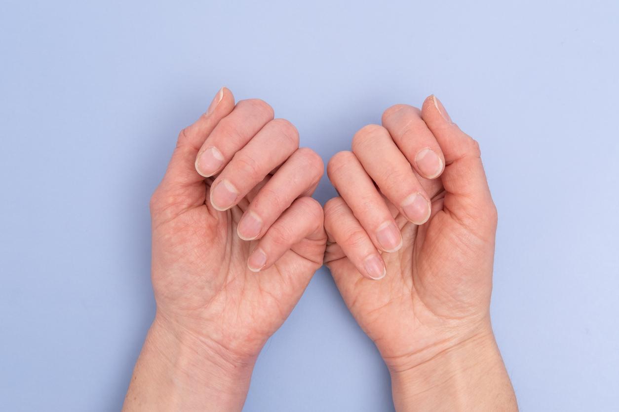Skin cancer: how to detect melanoma on your nails