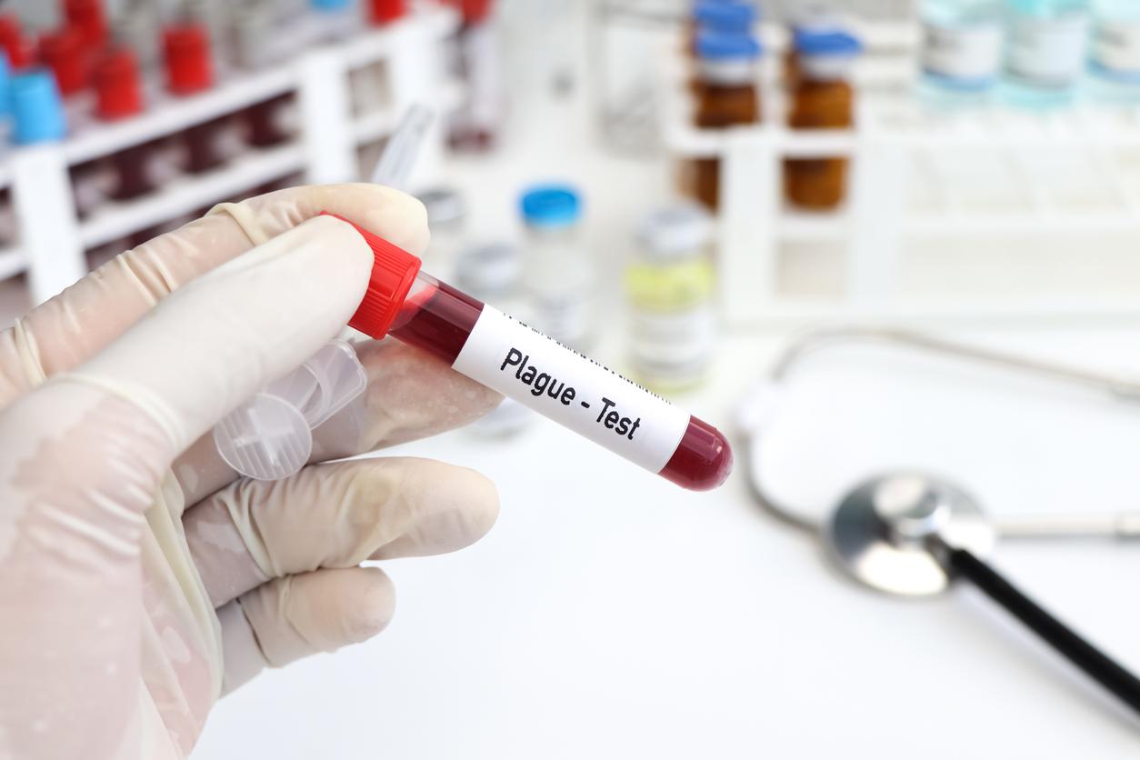 Peste pulmonaire : un premier cas mortel depuis près de 20 ans en Arizona 