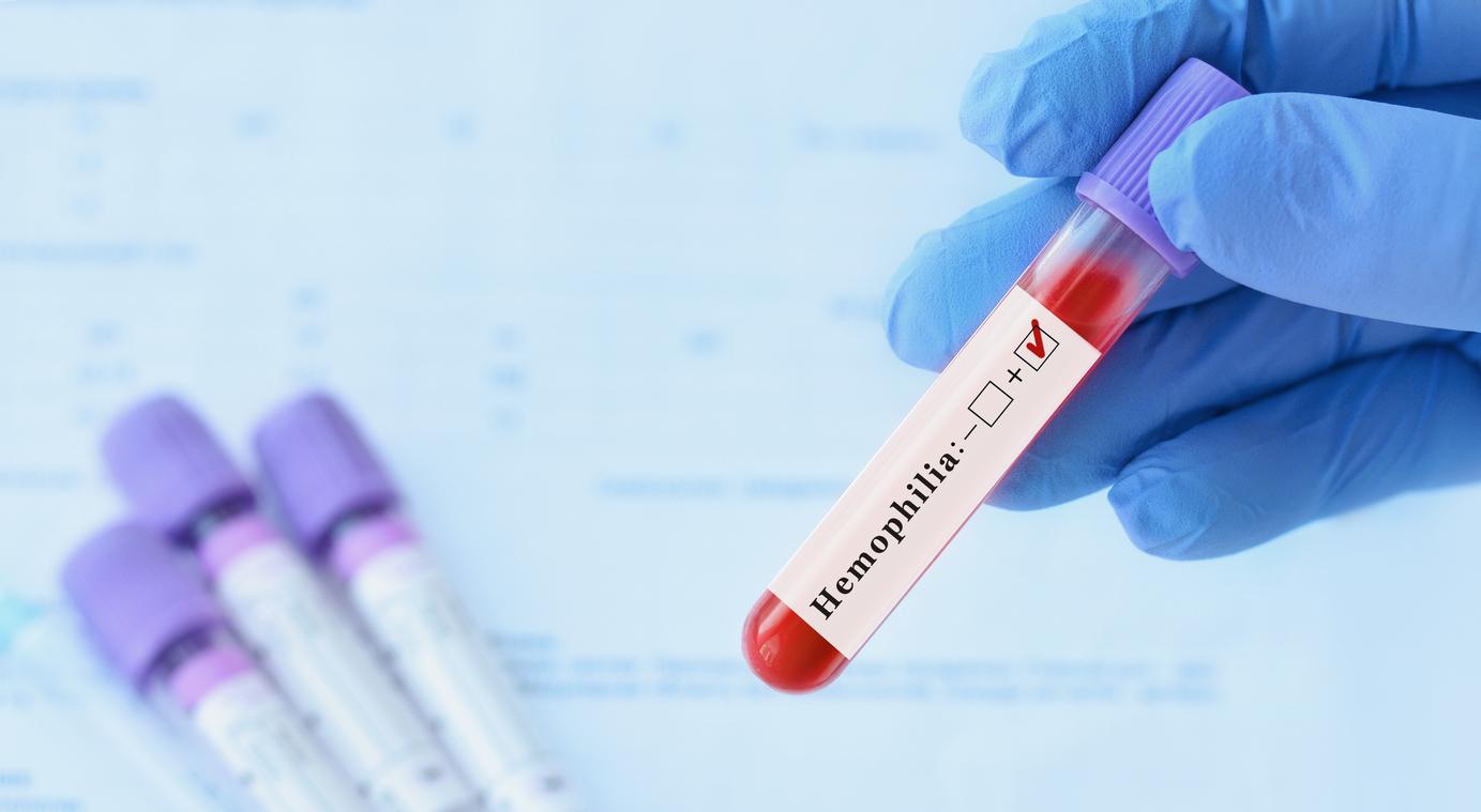Hémophilie : un nouveau traitement déployé au CHU de Nantes