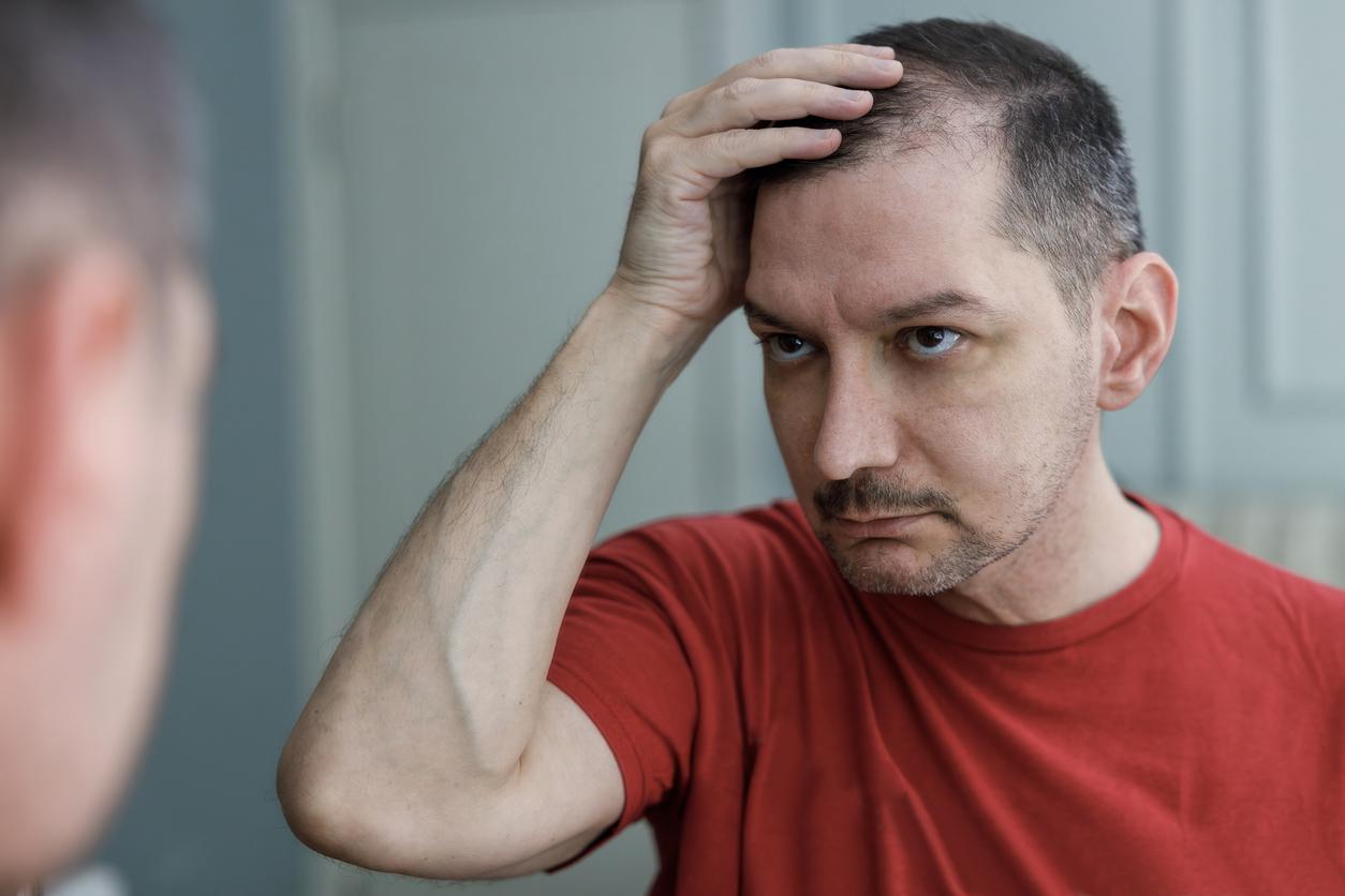 Alopécie : la médecine chinoise peut-elle vous rendre vos cheveux ?