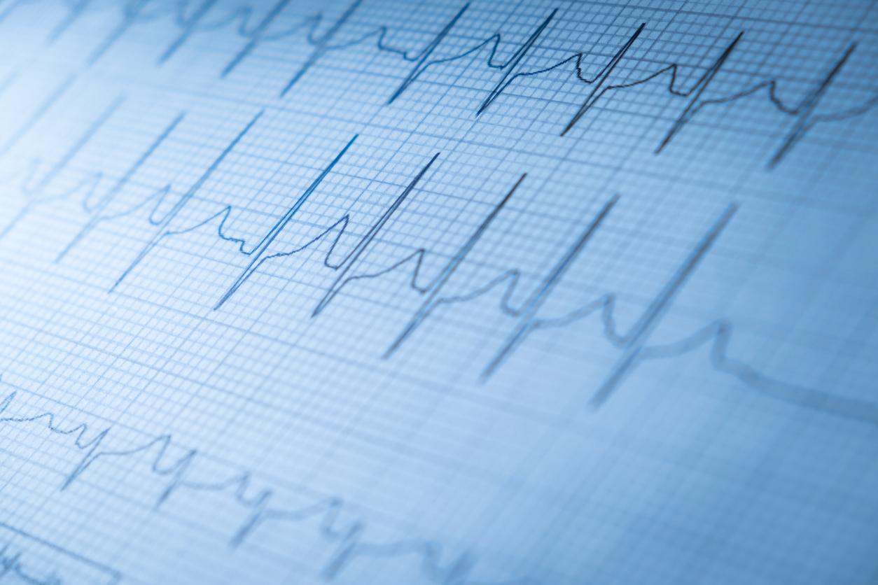 Complications chirurgicales : l’IA peut mieux les prédire que les médecins ? 