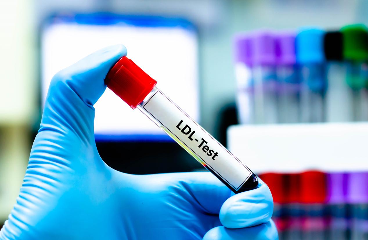 Cholestérol : le test classique est-il assez précis ?