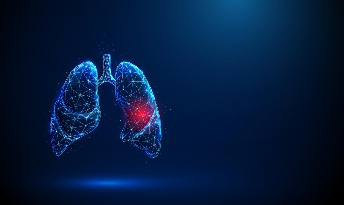 Cancer du poumon : ces infections courantes pourraient augmenter les risques