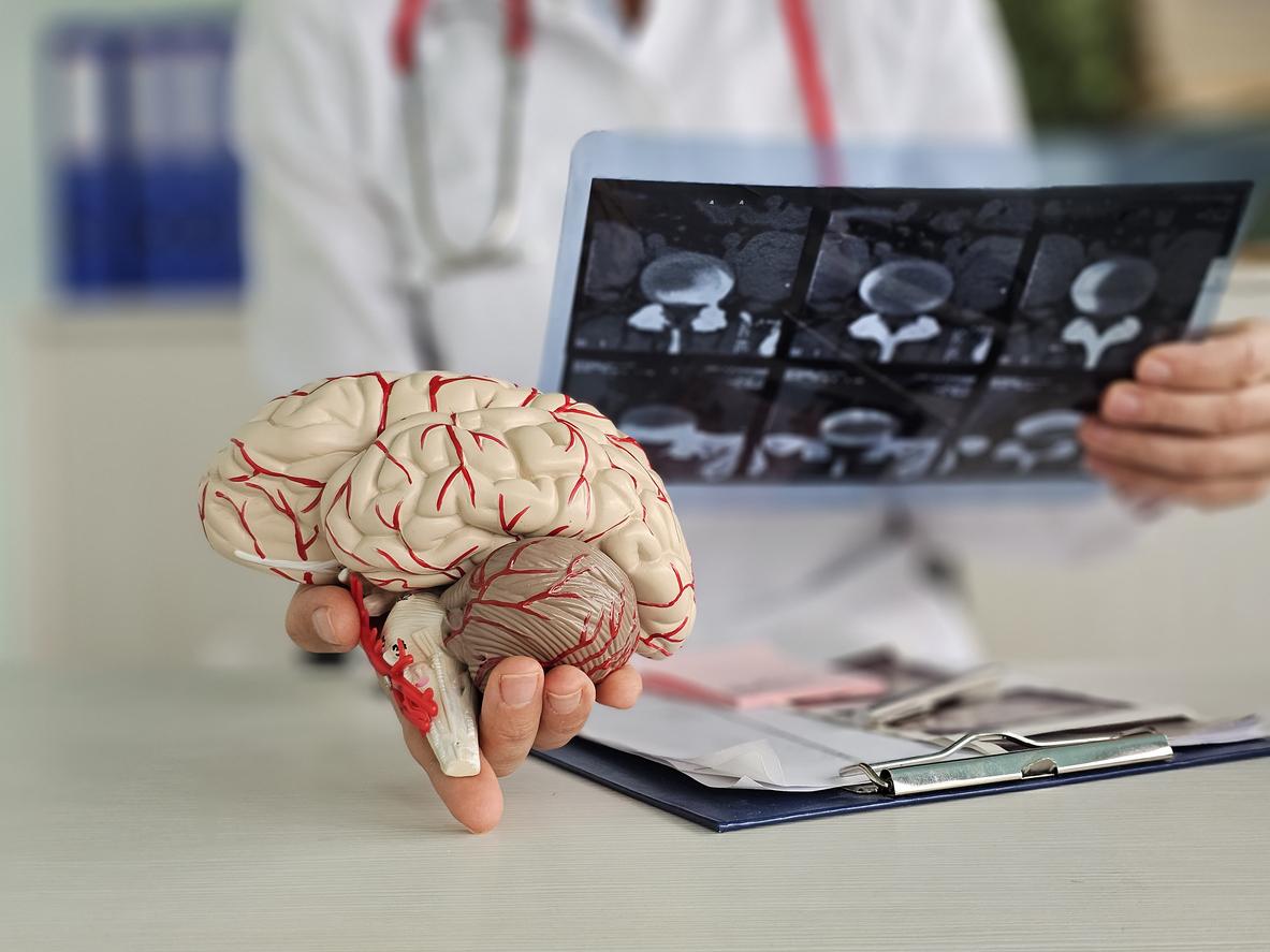 Diabète, infarctus : Alzheimer augmente les risques des troubles métaboliques et cardiaques