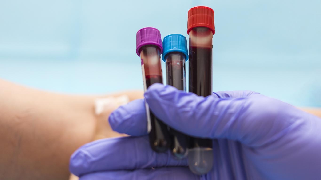 Pancréas : ce test pourrait détecter 90 % des cancers à un stade précoce