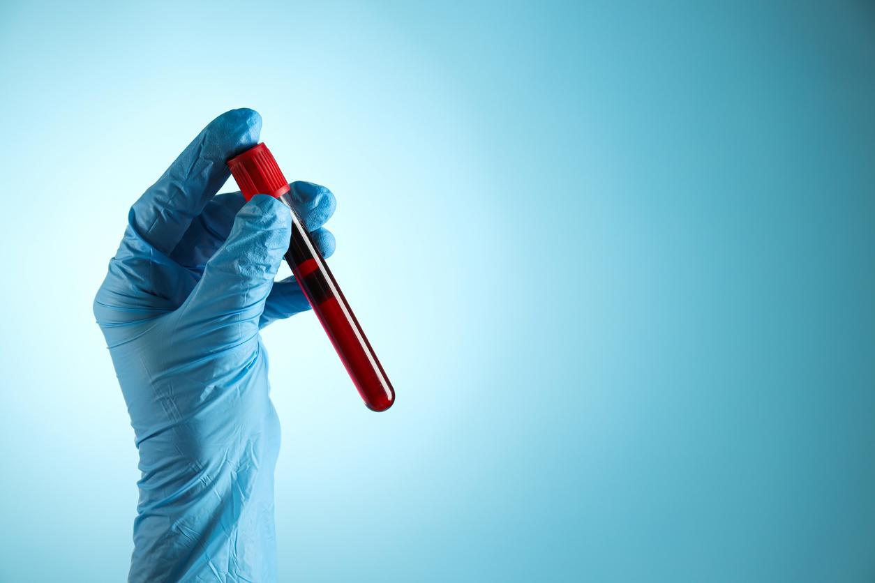 Alzheimer, Parkinson : un test sanguin pour les dépister avant les premiers symptômes