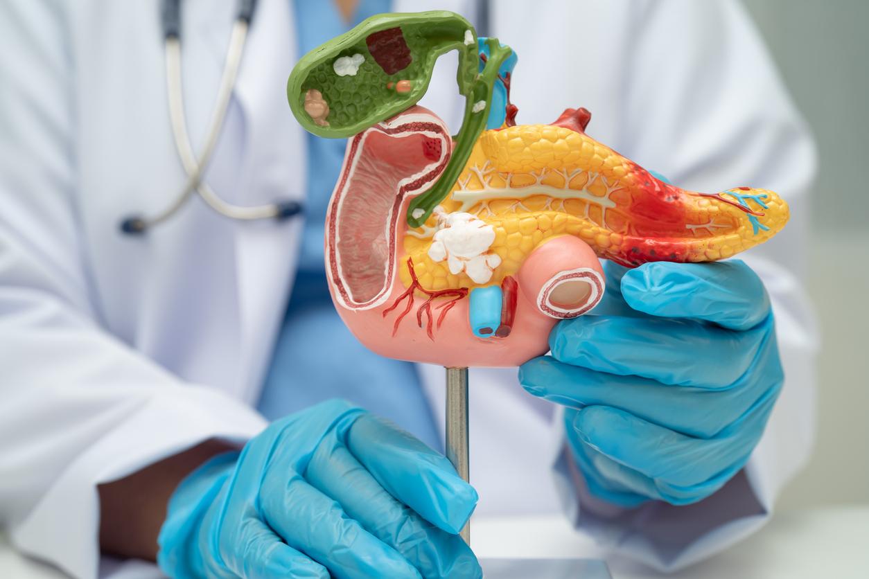 Cancer du pancréas : une nouvelle radiothérapie ciblée prometteuse