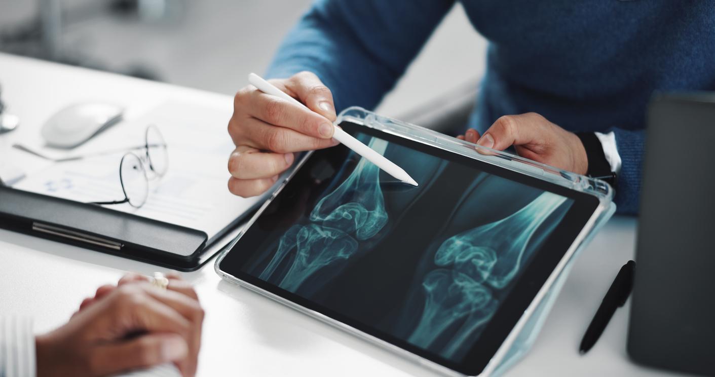 Arthrose du genou : ce que vous pouvez encore changer