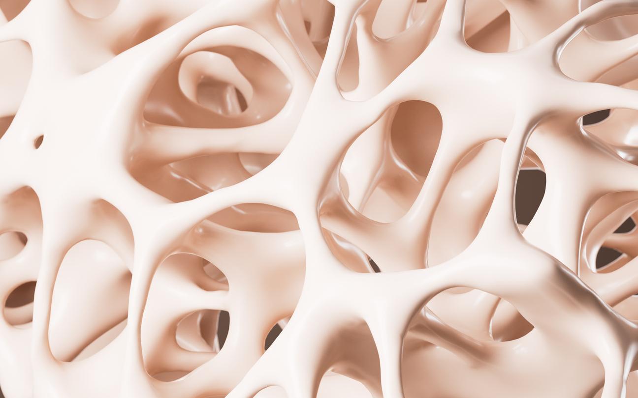 Cancer du sang : l’inflammation de la moelle osseuse pourrait expliquer son apparition 