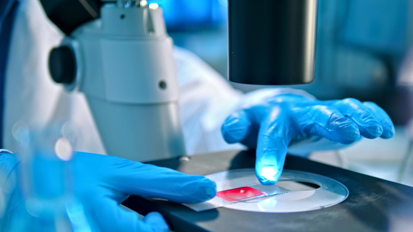 Traitement de la leucémie : la piste des combinaisons de médicaments