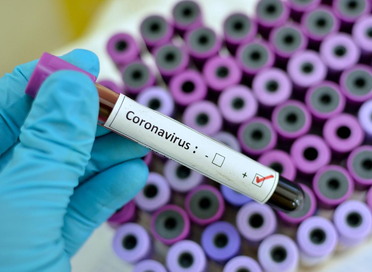 Coronavirus : le vaccin préparé par l’Institut Pasteur est un dérivé de la rougeole