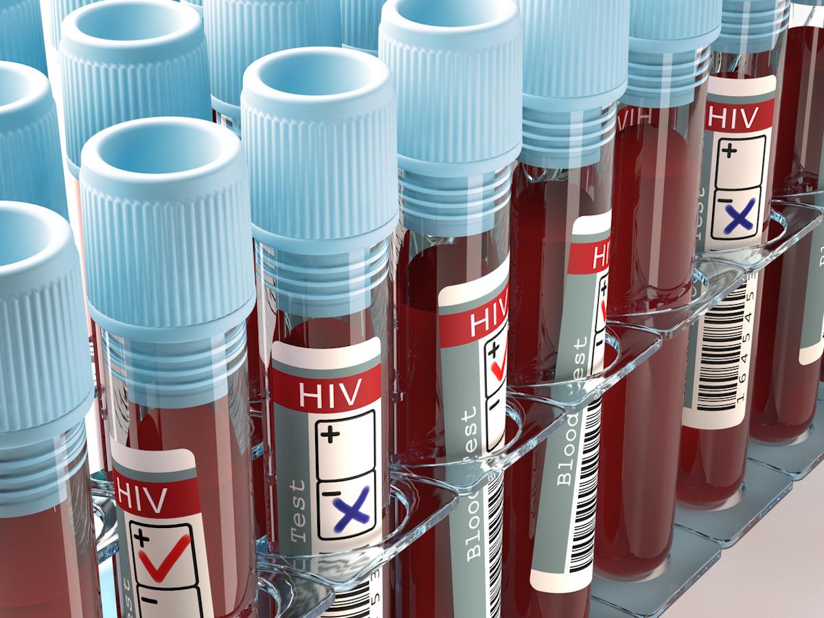 Méconnaissance de la maladie : un quart des jeunes se dit mal informé sur le sida
