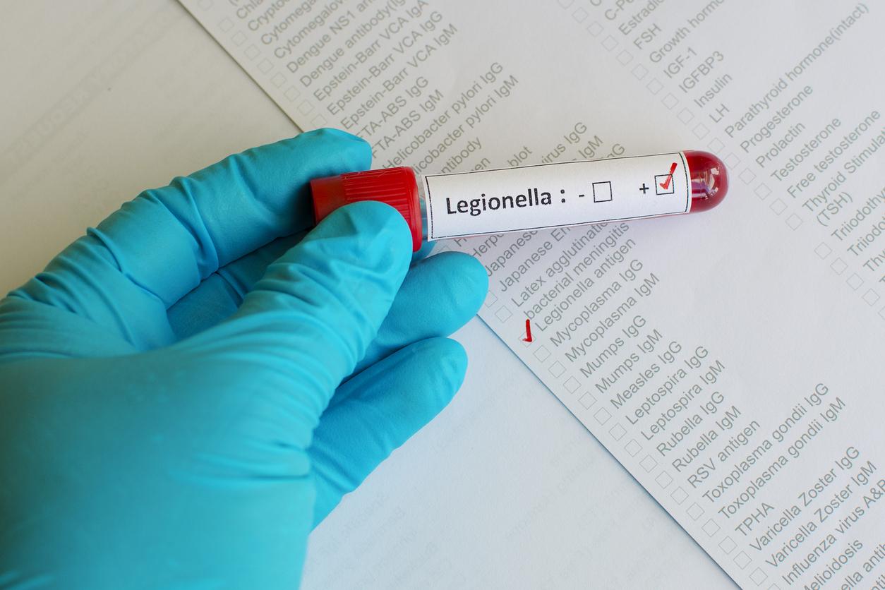 Légionellose en Suisse : quelle est l’origine de la contamination ?