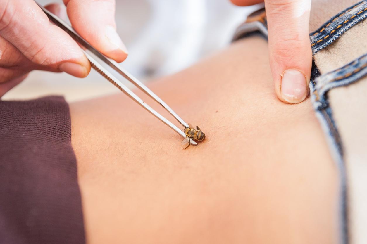 Maladie de Lyme : elle se fait piquer par des abeilles puis voit ses symptômes disparaître