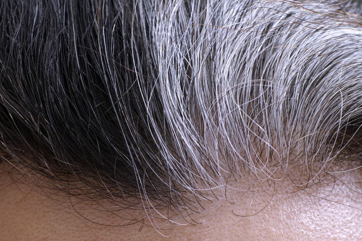 Vous avez des cheveux gris ? Cela refléterait une défense naturelle contre le risque de cancer