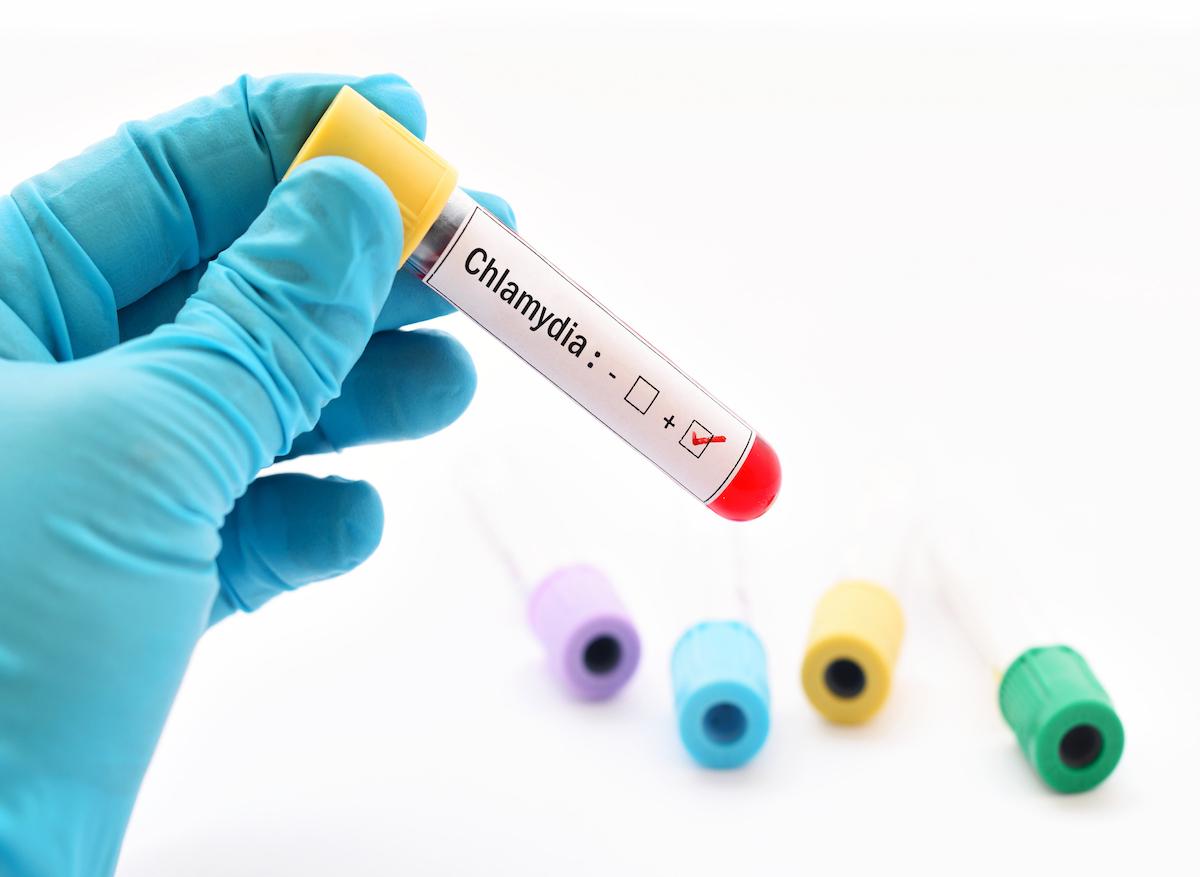 Chlamydia : un vaccin bientôt développé 