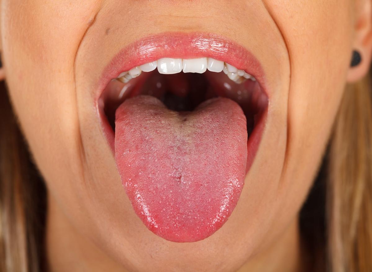 Cancer du poumon : les bactéries buccales permettent de prédire les risques