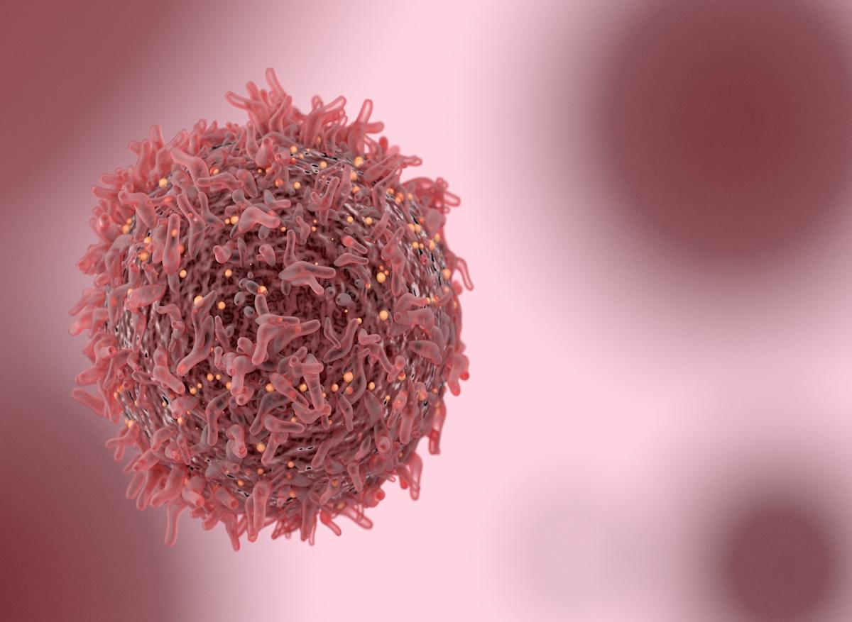 Cancer du sein : des champs électromagnétiques pour bloquer le déplacement des cellules cancéreuses