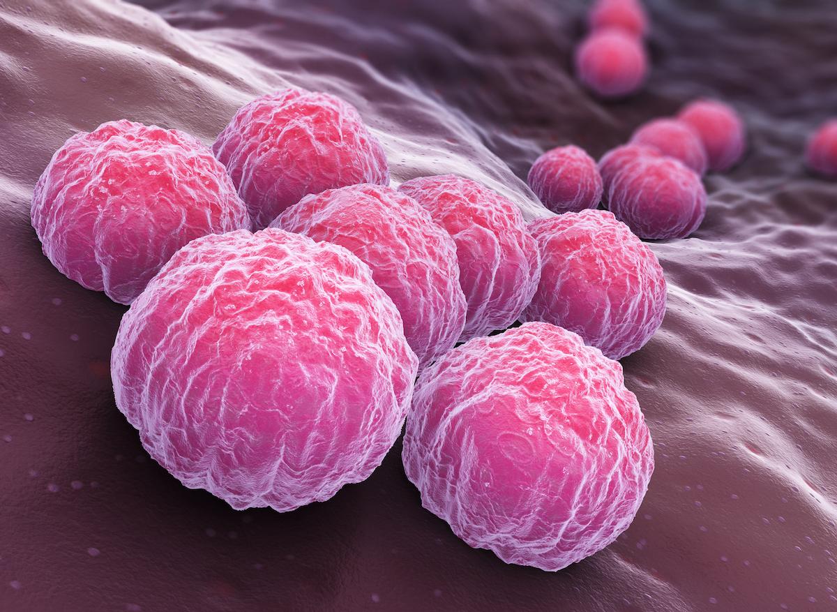 Chlamydia : elle augmenterait le risque de cancer et de grossesse extra-utérine
