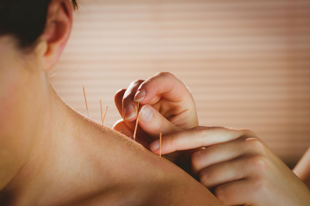 Diabète : l'acupuncture pourrait permettre de prévenir cette maladie 