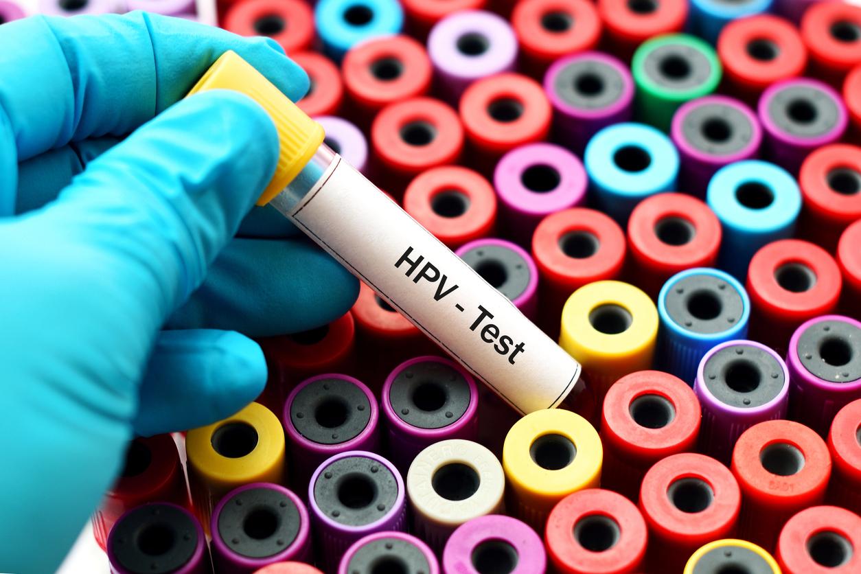 Cancer du col de l’utérus : un dépistage HPV tardif chez les femmes âgées limiterait les risques