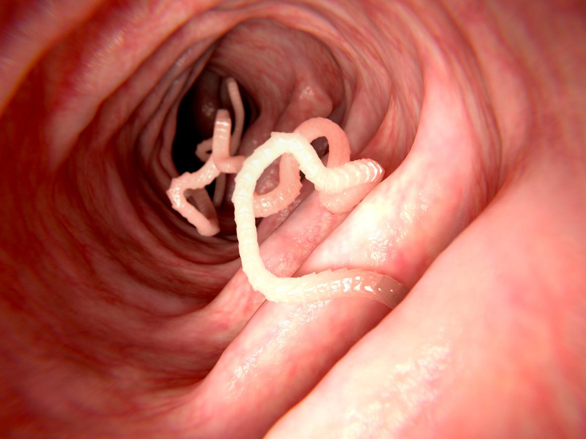 Ces signes qui montrent que vous avez un parasite intestinal