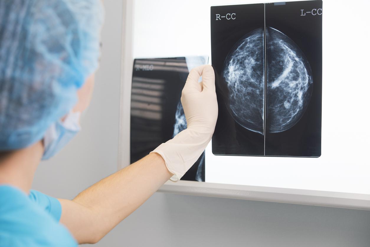 Cancer du sein : cette IA permet d'avoir un diagnostic dans la journée