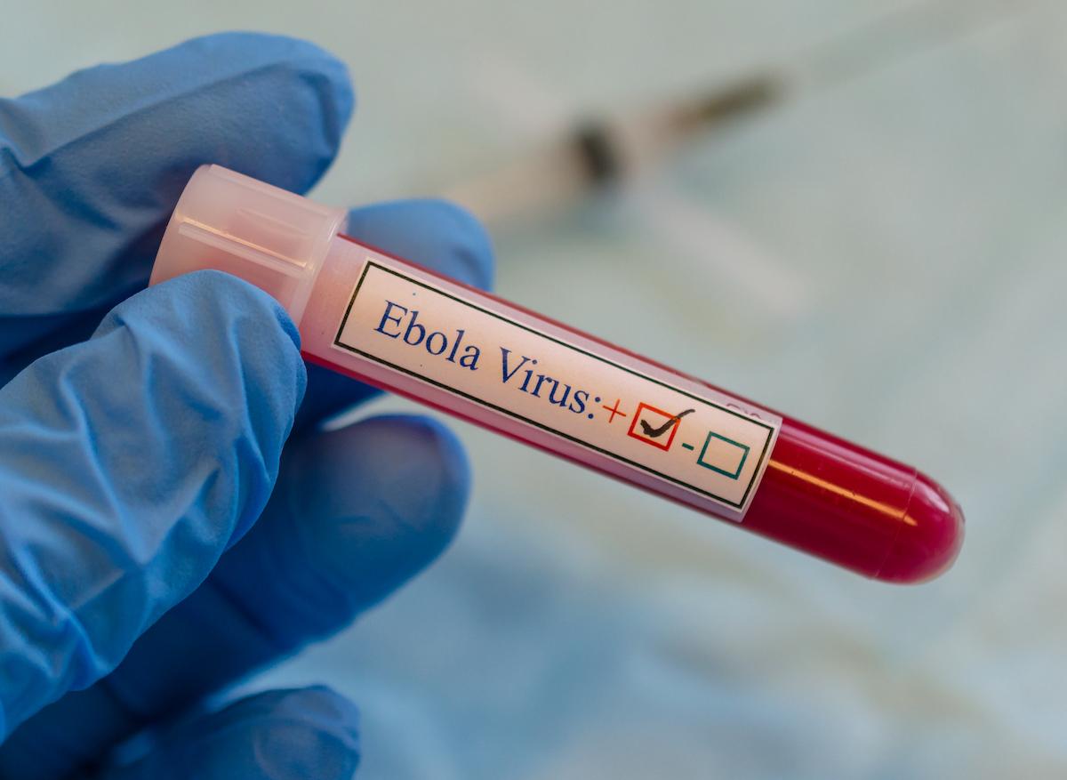 Ebola : le virus se serait caché pendant 5 ans dans le corps d’un patient avant de réapparaître
