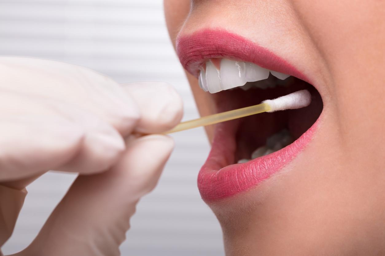 Cancer de la bouche : bientôt un dépistage salivaire en une heure ?